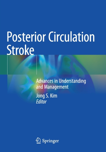 Posterior Circulation Stroke : Advances in Understanding and Management, Paperback / softback Book