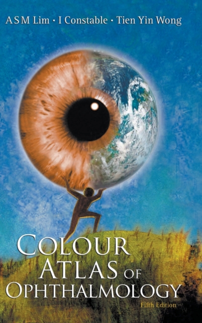 Colour Atlas Of Ophthalmology (Fifth Edition), Hardback Book