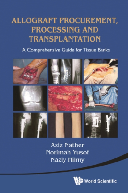 Allograft Procurement, Processing And Transplantation: A Comprehensive Guide For Tissue Banks, PDF eBook