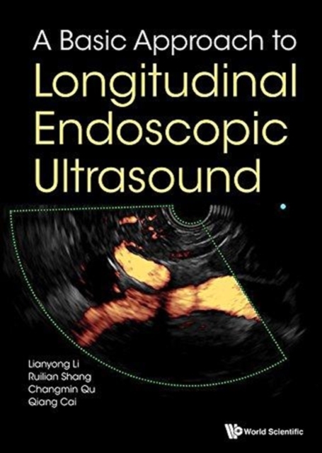 Basic Approach To Longitudinal Endoscopic Ultrasound, A, Hardback Book