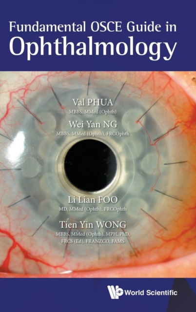Fundamental Osce Guide In Ophthalmology, Hardback Book
