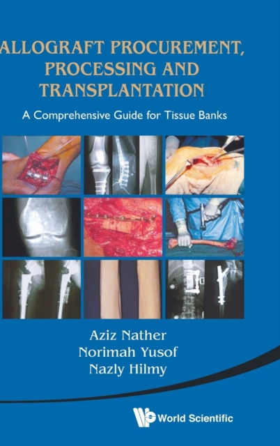 Allograft Procurement, Processing And Transplantation: A Comprehensive Guide For Tissue Banks, Hardback Book