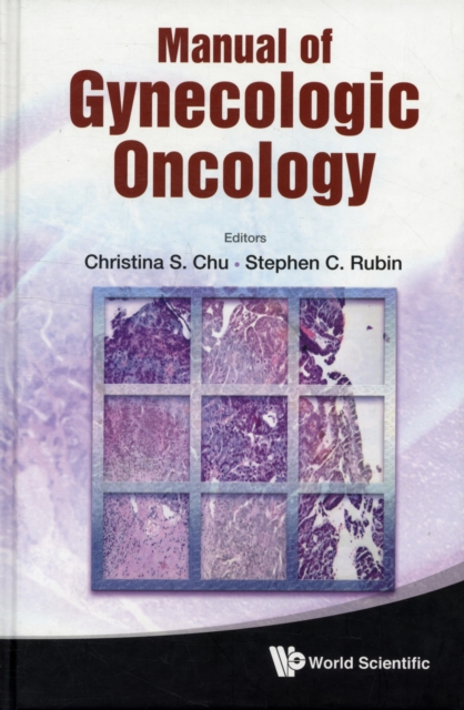 Manual Of Gynecologic Oncology, Hardback Book