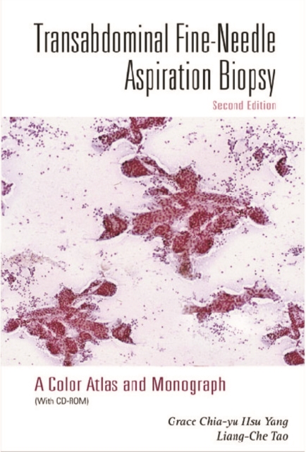 Transabdominal Fine-needle Aspiration Biopsy (2nd Edition): A Color Atlas And Monograph (With Cd-rom), PDF eBook