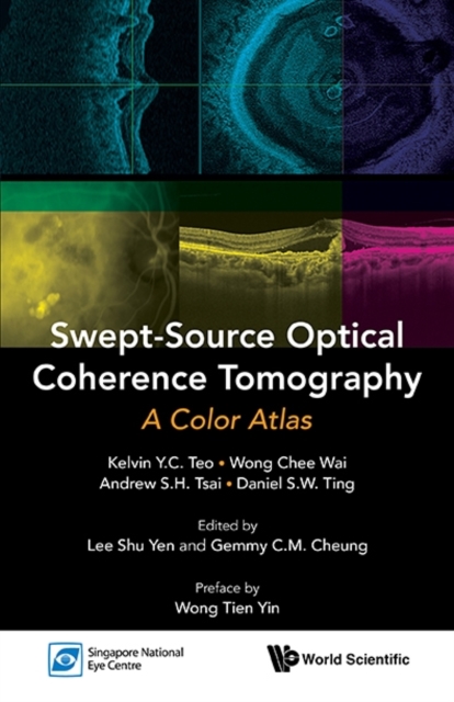 Swept-source Optical Coherence Tomography: A Color Atlas, Paperback / softback Book
