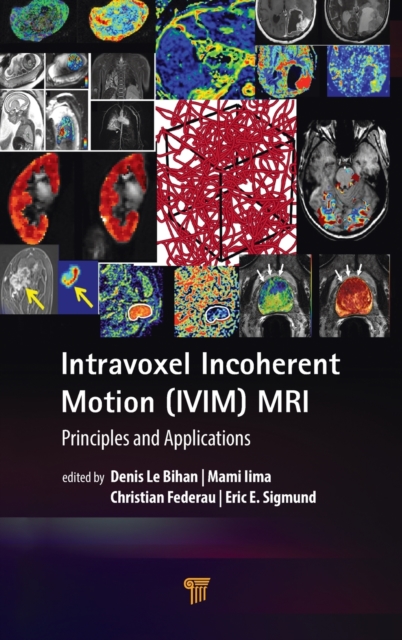 Intravoxel Incoherent Motion (IVIM) MRI : Principles and Applications, Hardback Book