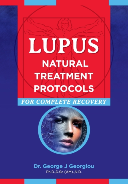Lupus : Natural Treatment Protocols for Complete Recovery, Paperback / softback Book