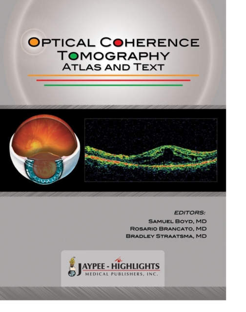 Optical Coherence Tomography : Atlas and Text, Hardback Book