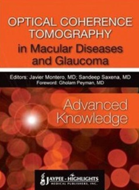 Optical Coherence Tomography in Macular Diseases and Glaucoma: Advanced Knowledge, Hardback Book