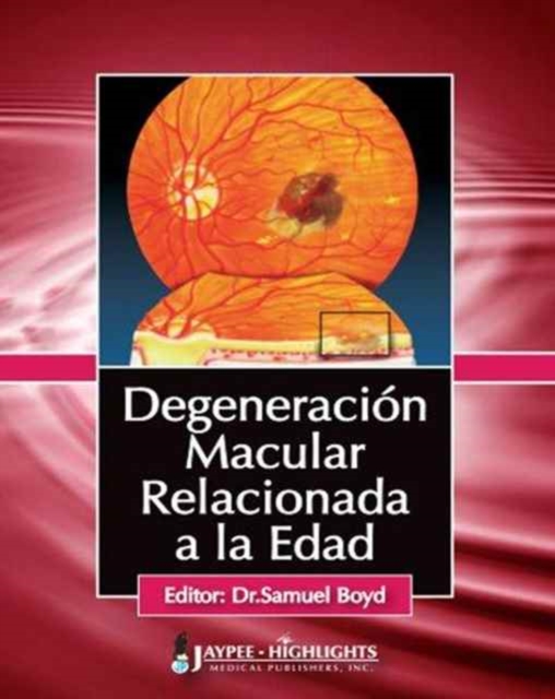 Degeneracion Macular Relacionada a la Edad, Paperback / softback Book