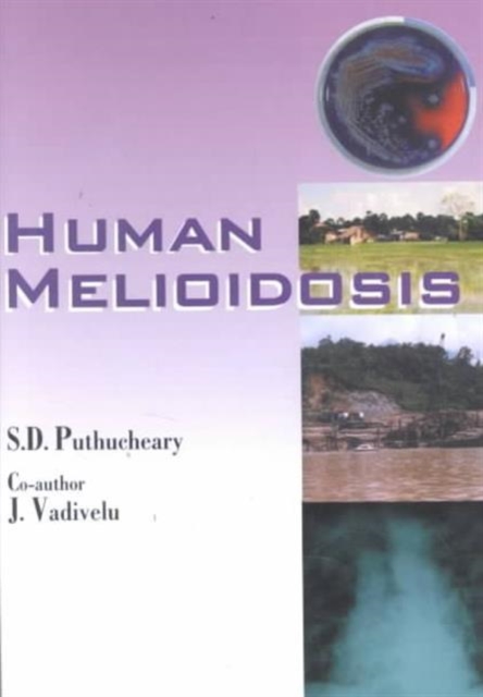 Human Melioidosis, Paperback / softback Book