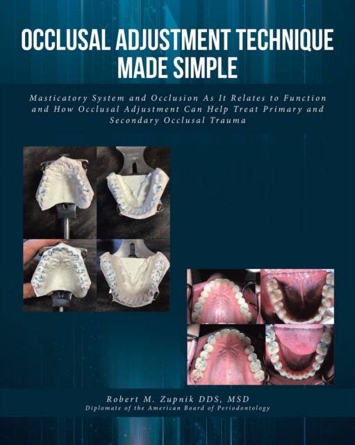Occlusal Adjustment Technique Made Simple : Masticatory System and Occlusion As It Relates to Function and How Occlusal Adjustment Can Help Treat Primary and Secondary Occlusal Trauma, EPUB eBook